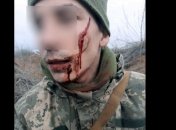 Появилось фото бойца, который дал отпор пробравшемуся на позиции вооруженному боевику