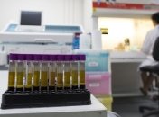 В Киеве на учете состоит 2819 больных СПИДом