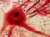 Ученые нашли нейроны реальности и вымысла