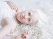 Потрясающие снимки людей-альбиносов, которые хочеться пересматривать (Фото) 