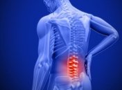 Супрун: Диагноза остеохондроз не существует