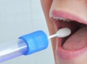 Ученые создали 10-минутный тест слюны для выявления рака