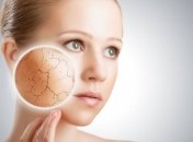 Дельный совет: как правильно удалять прыщи