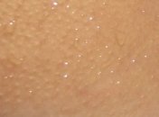 Ученые разработали аппарат, который "печатает" человеческую кожу