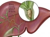 Как очистить печень в домашних условиях