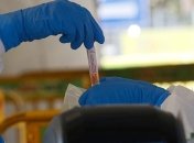 За минулу добу госпіталізовано 92 особи, серед них 4 дітей через коронавірусну інфекцію