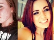 Удивительные преображения людей, которые смогли бросить употреблять наркотики (Фото)