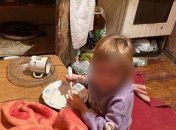 В Днепре госпитализировали детей, которых родители держали в антисанитарных условиях