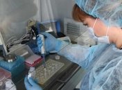 Українські вчені розробили тести для виявлення COVID-19 на ранній стадії