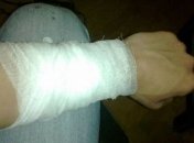 В киевском магазине вор перерезал себе вены