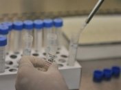 В Ирландии зафиксирован случай заболевания свиным гриппом