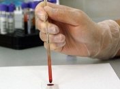 В Италии скончался второй человек от коронавируса