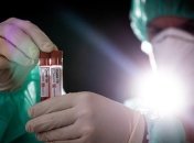 COVID-19 на Херсонщине: пожилая женщина смогла побороть недуг