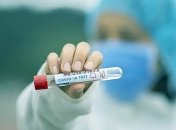 В Україні 11,5 тисяч нових випадків COVID-19