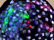 Ученые попали в этический скандал, скрестив человека с обезьяной для опытов