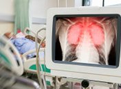 Проявляются через недели после острой стадии: Голубовская предупредила о последствиях коронавируса