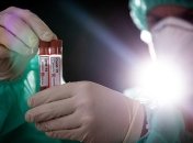 У Бельгії зросла кількість інфікованих до більш ніж 36 тисяч осіб