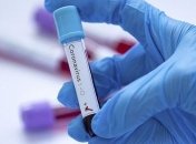 Підсумки брифінгу МОЗ з протидії поширення COVID-19 (Відео)