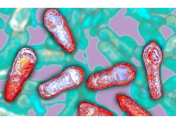 Ботулизм у младенцев: симптомы, лечение, профилактика