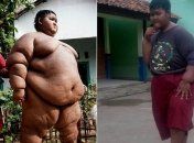 Самый толстый мальчик в мире похудел на 76 кг (Фото)