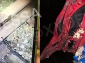 Школьник забавы ради залез на грузовой вагон в Одессе и получил мощный удар током: фото последствий