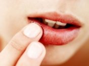 Методы повышения иммунитета при герпесе 