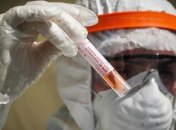 "Уже через неделю может произойти вспышка": эксперт предостерег от массовых поездок к морю