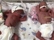 В Ужгороде женщина родила четверняшек: ей сделали уникальную операцию (видео)