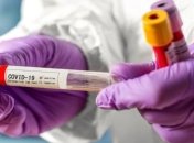 МОЗ повідомляє: В Україні зафіксовано 543 нові випадки COVID-19