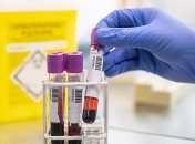 COVID-19 отступает: в Турции падает число новых случаев