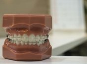 Стоматология при карантине: в Минздраве назвали новые правила работы клиник