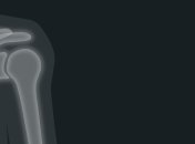 Четкие снимки и меньше излучения: новый рентгеновский аппарат