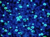 Бактерии тоже страдают: найдена еще одна опасность бедности 