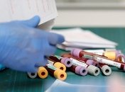 В Украине могут запустить массовое тестирование на антитела к коронавирусу