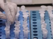 Загиблий у США Флойд був заражений коронавірусом