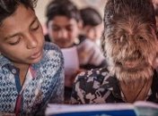 В Индии 13-летний мальчик страдает "синдромом оборотня" (Видео)