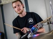 Роботизированный протез дал барабанщику уникальные способности