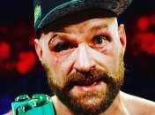 "Я шел в никуда": Фьюри вспомнил свою победу над Кличко