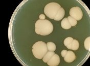 Ученые обнаружили смертельный грибок