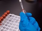 Безразличие и отсутствие денег: инфекционист объяснила, почему в Украине стали делать меньше ПЦР-тестов