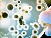 17 киевлян заболели сальмонеллезом