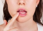 Лечение герпеса народными методами 