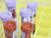 В Україні вже більше 15 тисяч жертв коронавірусу