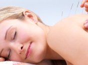 Иглоукалывание: за или против?