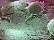 Ученые узнали, что раковые опухоли заразны