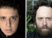 Невероятные изменения внешности за 20 лет жизни американского мужчины (Фото, Видео)