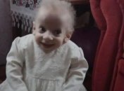 В Луцке из-за преждевременного старения умерла 8-летняя девочка 