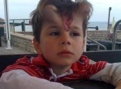 Мальчику вставили «рога», чтобы удалить родинку