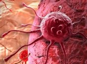 КТ увеличивает риск развития рака: Супрун об опасности «популярного» метода выявления коронавируса