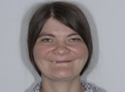 Ольга Мацик у 32 роки мала всього 3 зуби